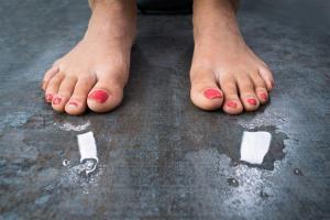 Transpiration des pieds chez une femme